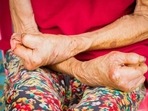 World Leprosy Day 2023: Signs and symptoms of leprosy, how it spreads, treatment(Shutterstock) World Leprosy Day 2023: Signs and symptoms of leprosy, how it spreads, treatment(Shutterstock)