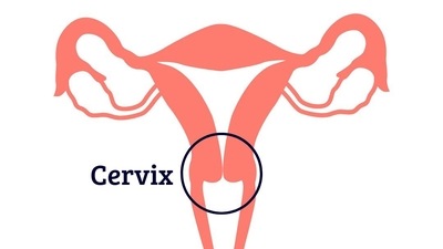 India accounts for the highest number of cervical cancer cases. Watch out for these warning signs (Photo by Twitter/RISCC_H2020) India accounts for the highest number of cervical cancer cases. Watch out for these warning signs (Photo by Twitter/RISCC_H2020)