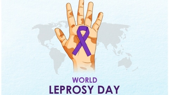 Leprosy Day Stock Illustrations – 562 Leprosy Day Stock Illustrations,  Vectors & Clipart - Dreamstime