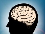 The results potentially provide a new conceptual framework for understanding brain inflammation and its relationship to brain cell loss and neurological deficits after head injury (Shutterstock) The results potentially provide a new conceptual framework for understanding brain inflammation and its relationship to brain cell loss and neurological deficits after head injury (Shutterstock)