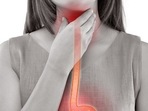 5 daily habits that are increasing your risk of esophageal cancer(Pixabay) 5 daily habits that are increasing your risk of esophageal cancer(Pixabay)