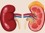 Weak kidneys? 6 effective home remedies to help improve kidney function(Freepik) Weak kidneys? 6 effective home remedies to help improve kidney function(Freepik)