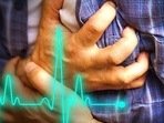 The biomaterial was tested and proven effective in treating tissue damage caused by heart attacks in both rodent and large animal models, according to the study.(Shutterstock) The biomaterial was tested and proven effective in treating tissue damage caused by heart attacks in both rodent and large animal models, according to the study.(Shutterstock)