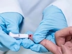 Sepsis increases risk of heart failure, rehospitalisation after discharge: Study Sepsis increases risk of heart failure, rehospitalisation after discharge: Study