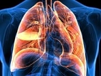 Lung cancer is the most common cancer in men in India and the second most common overall(Shutterstock) Lung cancer is the most common cancer in men in India and the second most common overall(Shutterstock)
