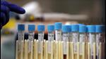 On January 30, officials had raided and sealed two other illegal laboratories in Sohna. (AP) On January 30, officials had raided and sealed two other illegal laboratories in Sohna. (AP)