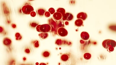 Sickle cell anaemia: What is it, warning signs and symptoms, causes and treatmen (Freepik) Sickle cell anaemia: What is it, warning signs and symptoms, causes and treatmen (Freepik)