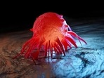Receiving a cancer diagnosis is a shock for most people(Spectral/Westend61/IMAGO) Receiving a cancer diagnosis is a shock for most people(Spectral/Westend61/IMAGO)
