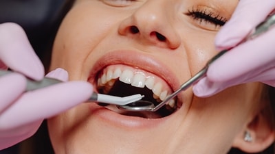 Declines in brain health may be connected to poor oral hygiene: Research (Karolina Grabowska) Declines in brain health may be connected to poor oral hygiene: Research (Karolina Grabowska)