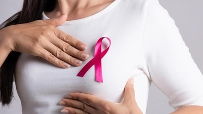 Breast cancer affects millions of women globally and understanding the factors contributing to its development is critical Breast cancer affects millions of women globally and understanding the factors contributing to its development is critical