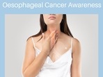 Oesophageal Cancer: Risk factors, symptoms, diagnosis, treatment, prevention tips (Photo by Twitter/CSGMallorca) Oesophageal Cancer: Risk factors, symptoms, diagnosis, treatment, prevention tips (Photo by Twitter/CSGMallorca)