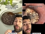 Dr Sermed Mezher showed the harmful impact of chia seeds on a person's food pipe.(Instagram/@drsermedmezher) Dr Sermed Mezher showed the harmful impact of chia seeds on a person's food pipe.(Instagram/@drsermedmezher)
