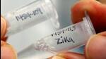 As per officials, on Thursday, 16 samples of suspected patients were sent to NIV for testing for the virus infection. Out of these 16 samples, 9 samples are of pregnant women from the Mundhwa area and three from the Kothrud area. (REPRESENTATIVE PHOTO) As per officials, on Thursday, 16 samples of suspected patients were sent to NIV for testing for the virus infection. Out of these 16 samples, 9 samples are of pregnant women from the Mundhwa area and three from the Kothrud area. (REPRESENTATIVE PHOTO)
