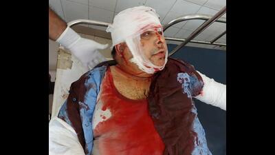 An injured Shiv Sena Punjab leader Sandeep Thapar after he was attacked with swords at the civil hospital in Ludhiana on Friday. (HT Photo) An injured Shiv Sena Punjab leader Sandeep Thapar after he was attacked with swords at the civil hospital in Ludhiana on Friday. (HT Photo)