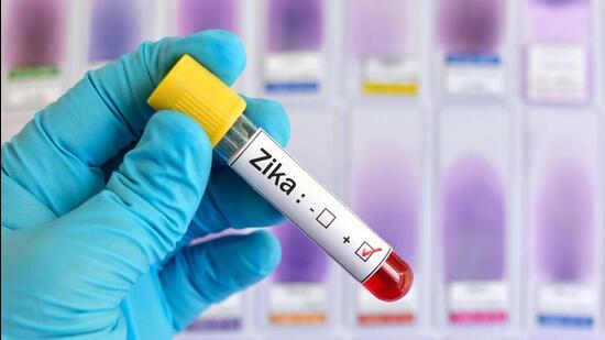Two more women have tested positive for Zika virus infection as per the reports received from a private lab. Samples of both women will be sent to the NIV for confirmation, said officials. (REPRESENTATIVE PHOTO)