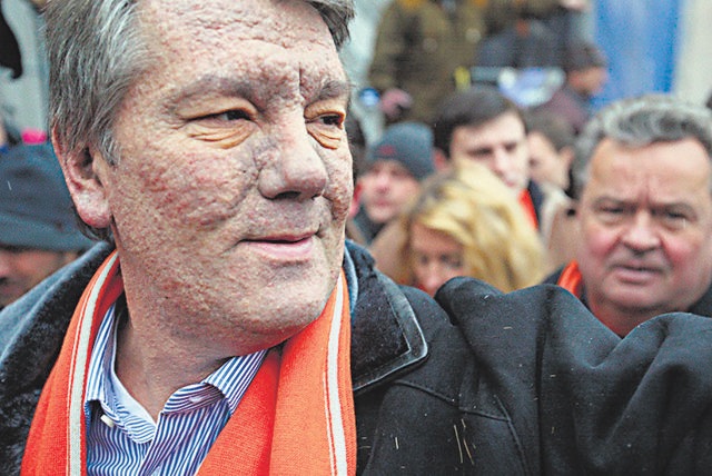 The chloracne on the face of Viktor Yushchenko, former president of Ukraine and a victim of dioxin poisoning, speaks to the effects of this toxin on the human body. (Getty Images) The chloracne on the face of Viktor Yushchenko, former president of Ukraine and a victim of dioxin poisoning, speaks to the effects of this toxin on the human body. (Getty Images)