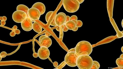 Candida auris fungi has emerged to be resistant to multiple antifungal medications. (DW/Kateryna Kon/IMAGO) Candida auris fungi has emerged to be resistant to multiple antifungal medications. (DW/Kateryna Kon/IMAGO)