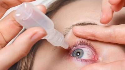“A spike in cases of conjunctivitis, styes, and fungal eye infections is typically observed during this time," said Dr. Siddharth Sain. (Freepik) “A spike in cases of conjunctivitis, styes, and fungal eye infections is typically observed during this time," said Dr. Siddharth Sain. (Freepik)