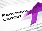 igns of pancreatic cancer in the later stages include yellowing of the skin, upper abdominal pain, dark urine, itchy skin, nausea and fatigue.