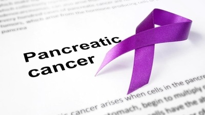 igns of pancreatic cancer in the later stages include yellowing of the skin, upper abdominal pain, dark urine, itchy skin, nausea and fatigue. (Shutterstock) igns of pancreatic cancer in the later stages include yellowing of the skin, upper abdominal pain, dark urine, itchy skin, nausea and fatigue. (Shutterstock)
