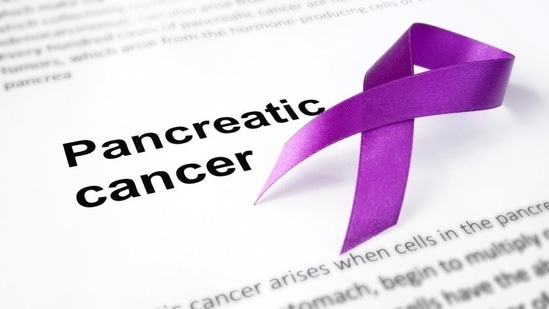 igns of pancreatic cancer in the later stages include yellowing of the skin, upper abdominal pain, dark urine, itchy skin, nausea and fatigue.(Shutterstock)