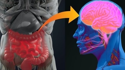 Study unveils gut microbiome's role in Autism, offering new diagnostic insights, treatment possibilities (Photo by  Jesse Grant  on Getty Images)