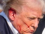 Republican presidential candidate and former President Donald Trump was shot at during a campaign rally in Pennsylvania on Sunday (AP Photo)
