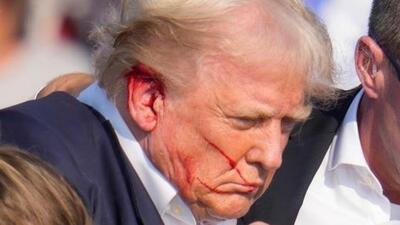 Republican presidential candidate and former President Donald Trump was shot at during a campaign rally in Pennsylvania on Sunday (AP Photo) Republican presidential candidate and former President Donald Trump was shot at during a campaign rally in Pennsylvania on Sunday (AP Photo)