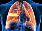 Surprisingly, an average Indian suffering from lung cancer is at least ten years younger than a person with lung cancer in the West. Lung cancer also affects non-smokers. (Shutterstock) Surprisingly, an average Indian suffering from lung cancer is at least ten years younger than a person with lung cancer in the West. Lung cancer also affects non-smokers. (Shutterstock)