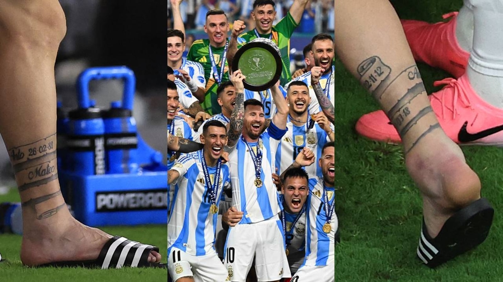 Images of Lionel Messi's ‘destroyed’ ankle go viral after freak Copa ...