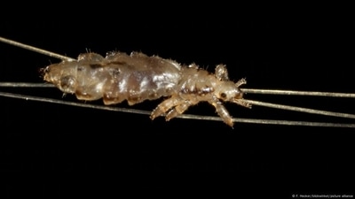Clingy little louse: Head lice are easy to get, but difficult to get rid of. (F. Hecker/blickwinkel/picture alliance ) Clingy little louse: Head lice are easy to get, but difficult to get rid of. (F. Hecker/blickwinkel/picture alliance )