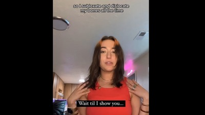 Snapshot of the influencer who dislocates her shoulder on purpose. Snapshot of the influencer who dislocates her shoulder on purpose.