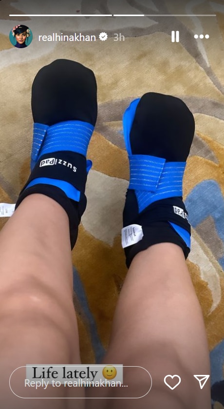 Hina Khan shared a picture of her therapy socks in her Instagram story.