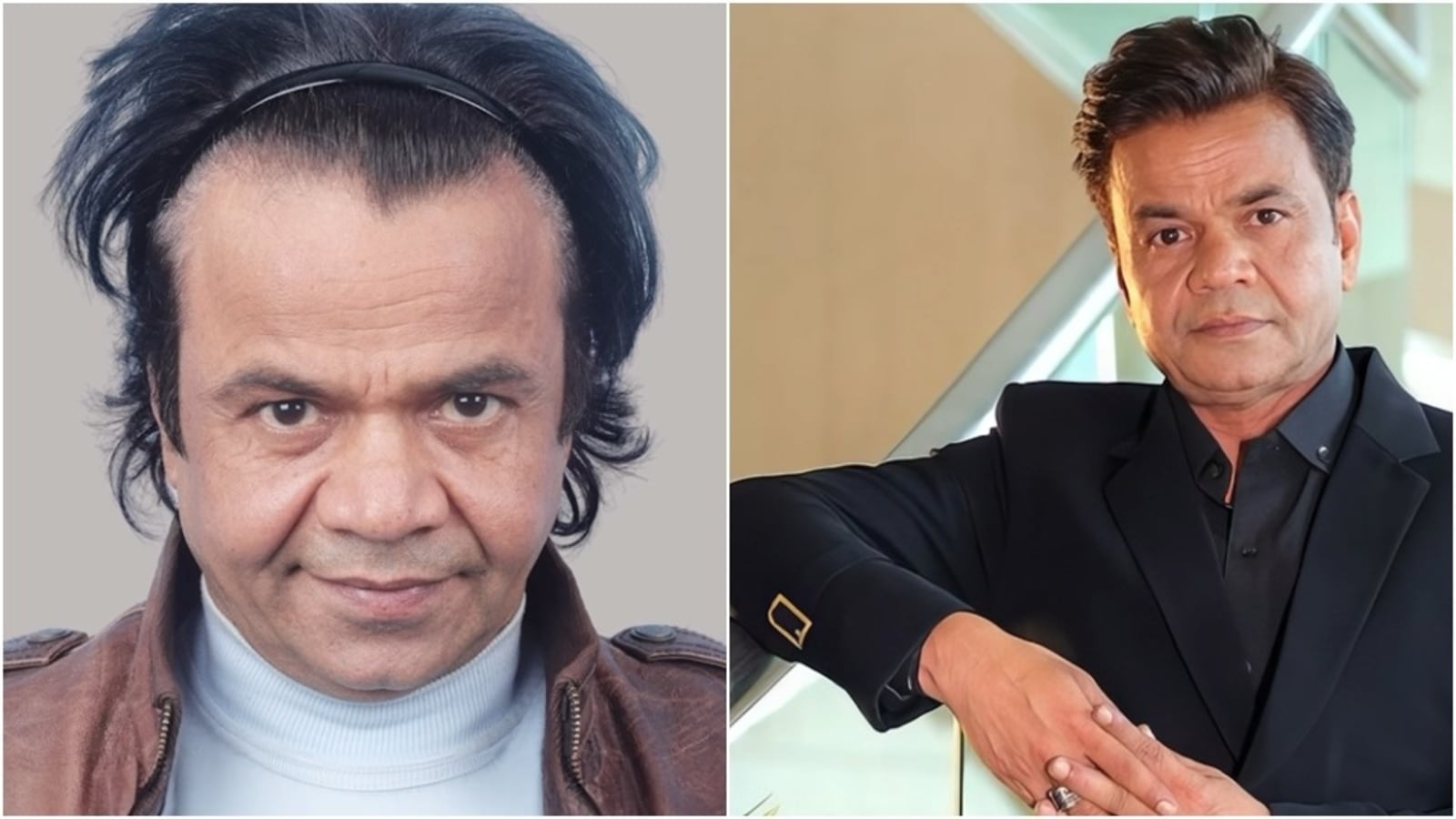 Clinic shares Rajpal Yadav’s hair transplant journey in pre and post-surgery video. Watch