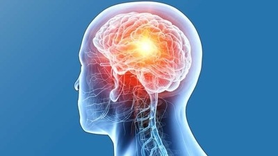 Blood cancer medication makes radiation therapy on brain tumours more effective, study reveals how (Photo by Dr. Vijayanand Reddy) Blood cancer medication makes radiation therapy on brain tumours more effective, study reveals how (Photo by Dr. Vijayanand Reddy)
