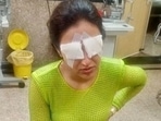 Jasmine Bhasin spoke about what happened to her eyes. Jasmine Bhasin spoke about what happened to her eyes.