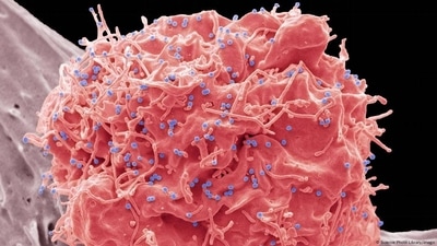Still no vaccine for HIV, but long-active injectable medicines are providing new hope (Science Photo Library/imago ) Still no vaccine for HIV, but long-active injectable medicines are providing new hope (Science Photo Library/imago )