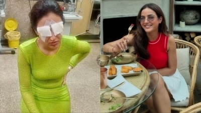 Jasmine Bhasin spoke about what happened to her eyes. Jasmine Bhasin spoke about what happened to her eyes.