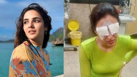 Actor Jasmin Bhasin has shared how her eyes were severely affected due to contact lenses.