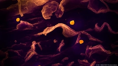In this photo from a scanning electron microscope, the Nipah virus (colored yellow) can be seen budding from the surface of a cell. (NIH / IMAGE POINT FR/picture alliance) In this photo from a scanning electron microscope, the Nipah virus (colored yellow) can be seen budding from the surface of a cell. (NIH / IMAGE POINT FR/picture alliance)