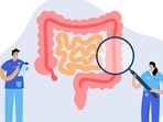 Groundbreaking research sheds light on liver metastasis in colorectal cancer