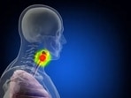 "Generally, head and neck cancer is more than 90% tobacco-related, especially oral cavity cancer. But HPV infection rates leading to cancer are on increasing trend," said Dr. A. K. Dewan.
