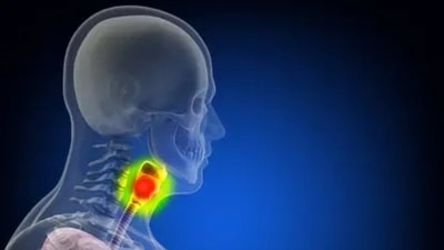 "Generally, head and neck cancer is more than 90% tobacco-related, especially oral cavity cancer. But HPV infection rates leading to cancer are on increasing trend," said Dr. A. K. Dewan. (Unsplash) "Generally, head and neck cancer is more than 90% tobacco-related, especially oral cavity cancer. But HPV infection rates leading to cancer are on increasing trend," said Dr. A. K. Dewan. (Unsplash)