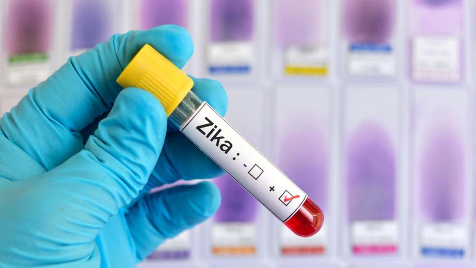 PMC has one pre-natal scans facility to test Zika infection despite rise in cases