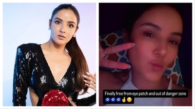 Jasmine Bhasin suffered corneal damage after wearing contact lenses. Jasmine Bhasin suffered corneal damage after wearing contact lenses.