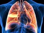 Every year, World Lung Cancer Day is observed on August 1.(Shutterstock) Every year, World Lung Cancer Day is observed on August 1.(Shutterstock)