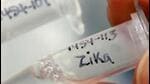 Two fresh cases of Zika virus were reported on Wednesday in Pune. (REPRESENTATIVE PHOTO) Two fresh cases of Zika virus were reported on Wednesday in Pune. (REPRESENTATIVE PHOTO)