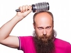 There are now many methods to restore hair growth for men and women who have lost their hair. (DW/picture alliance/Zoonar) There are now many methods to restore hair growth for men and women who have lost their hair. (DW/picture alliance/Zoonar)