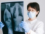 lungs_x_ray lungs_x_ray