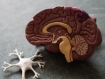 Experts debate the feasibility of preventing dementia through risk factor reduction.